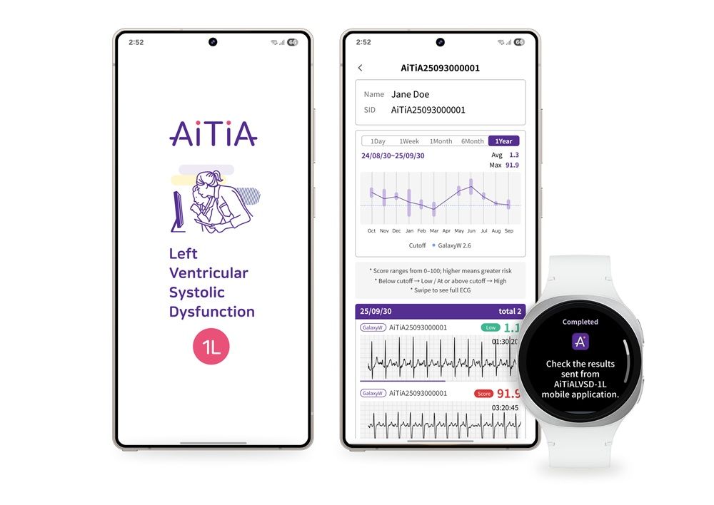Samsung Gets World-First Approval for Heart Failure Detection Watch